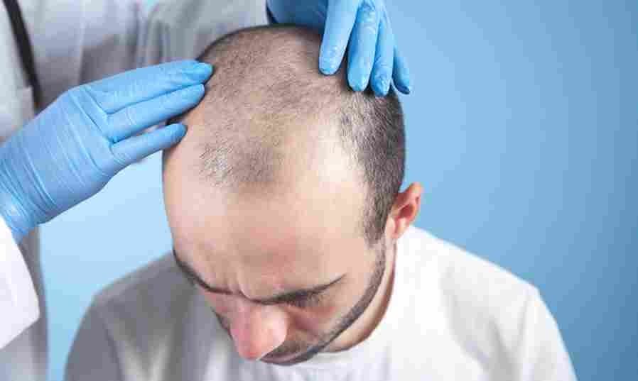 Hair Transplant Turkey – Your Journey to Fuller Hair Starts Here