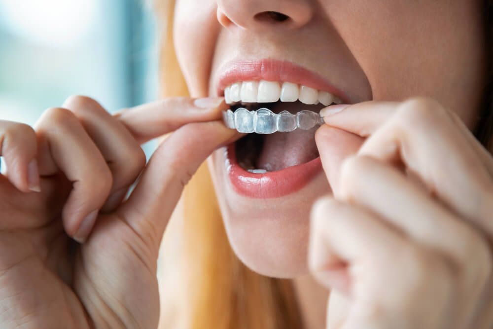 Why Our Dental Services Stand Out as the Best Dental Clinic in Chennai